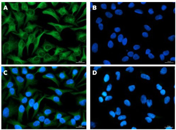Mouse IgG (gamma 1, 2a, 2b and 3 chain) Antibody DyLight™ 488 Conjugated